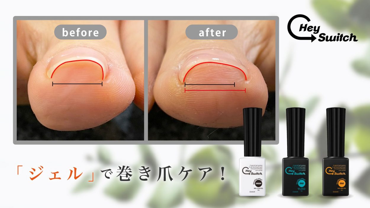 巻き 爪 ジェル ネイル